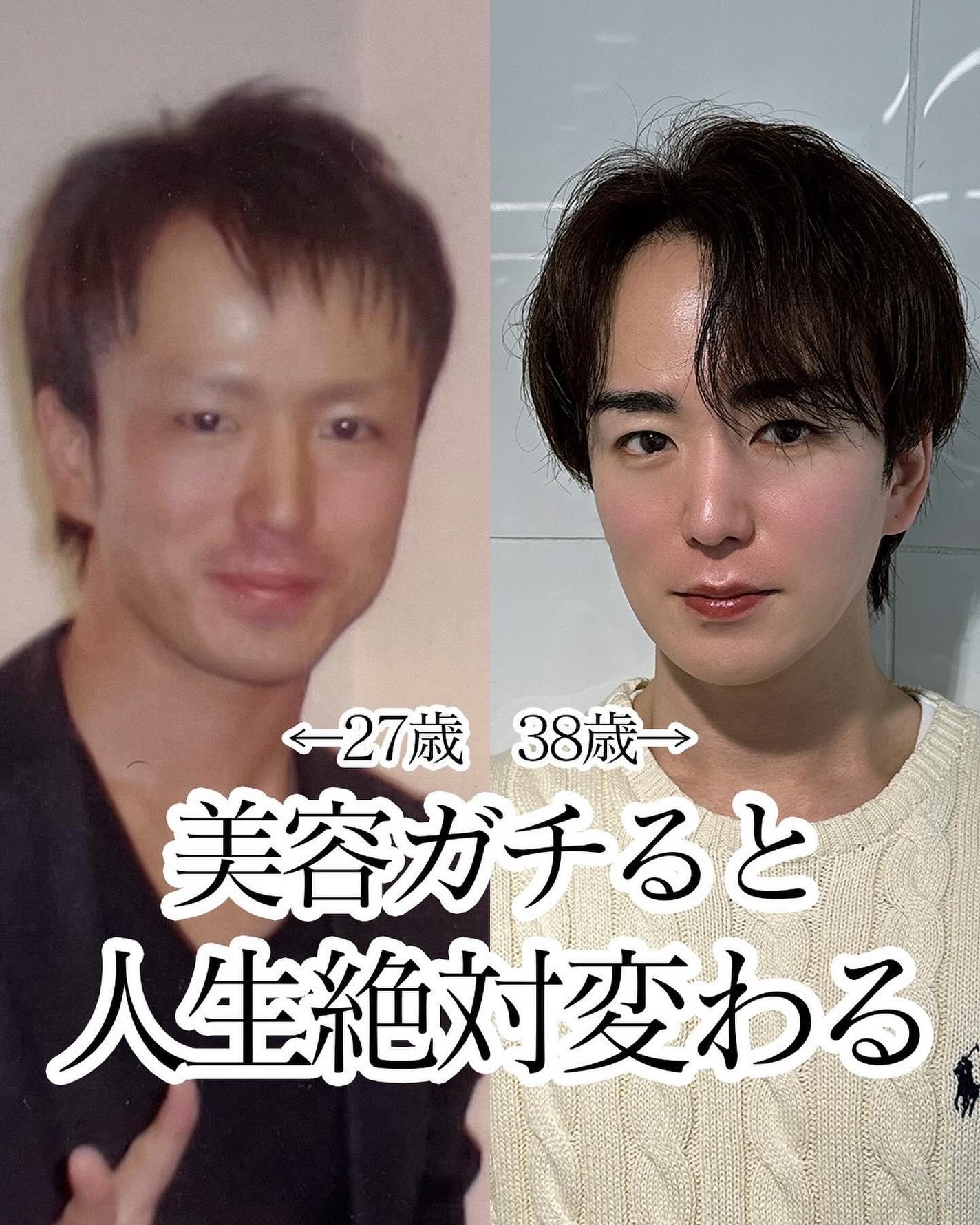 ヒロキ|40歳の美容家 ヘアケア スキンケア on LIPS 「30代から始めた美容だけど、頑張ってきてよかったと本当に思って..」(1枚目)