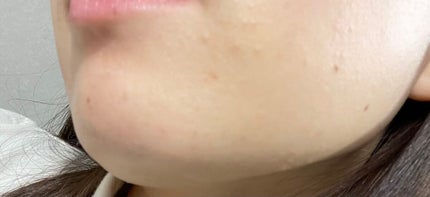 トリートメント クレンジング ミルク/COVERMARK/ミルククレンジングを使ったクチコミ(2枚目)