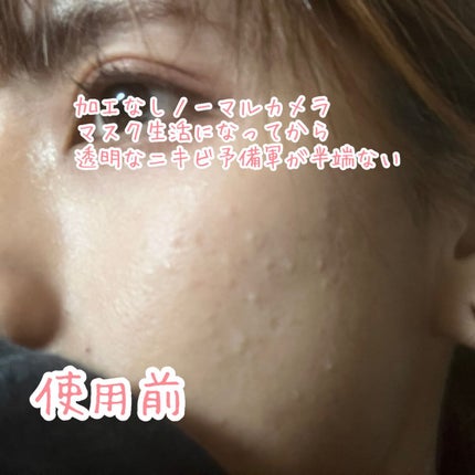 CICA カプセルマスク/VT/洗い流すパック・マスクを使ったクチコミ(3枚目)