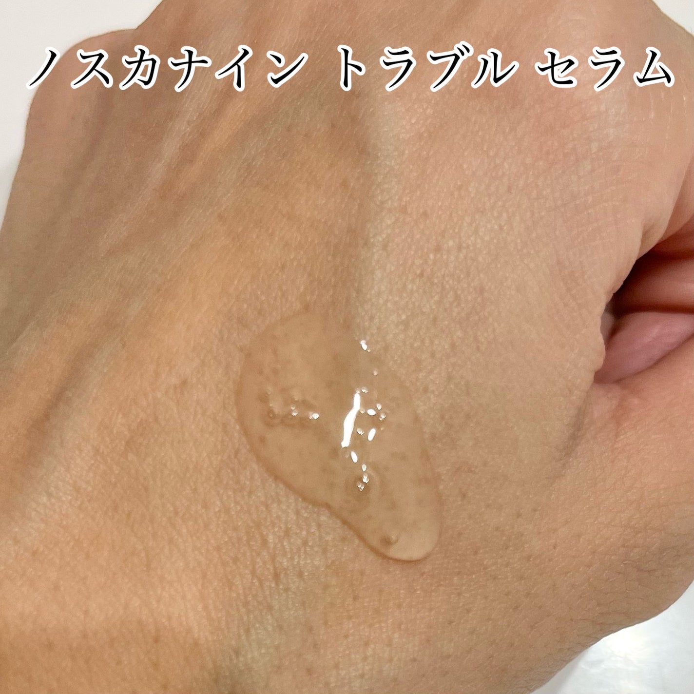 ノスカナイン トラブル セラム/FATION/美容液を使ったクチコミ(2枚目)