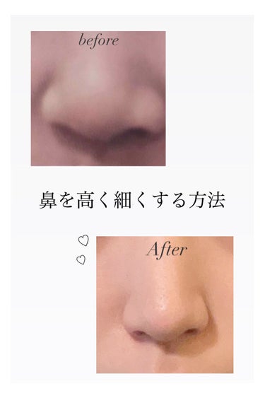 つぐみ🥞 フォロバ on LIPS 「こんにちは！つぐみと申します！今回は私が鼻の形を変えた方法を伝..」（1枚目）