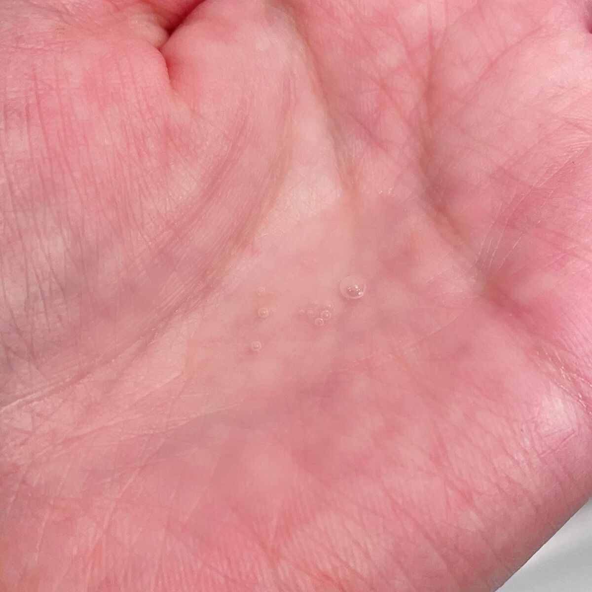 Melano Hunt/fibonacci/化粧水を使ったクチコミ（3枚目）