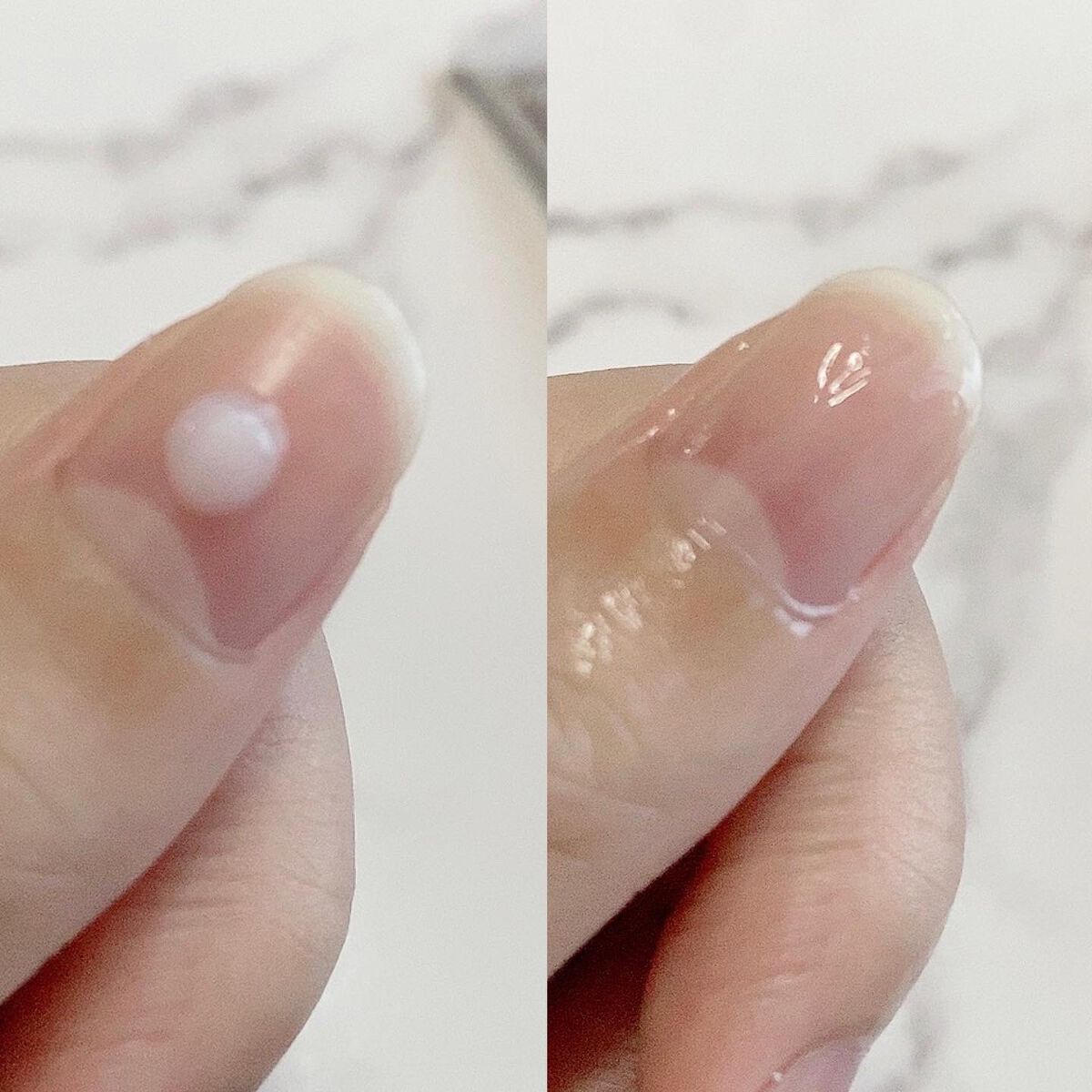 薬用 クリアストロングショット アルファ/北の快適工房/レッグ・フットケアを使ったクチコミ(3枚目)