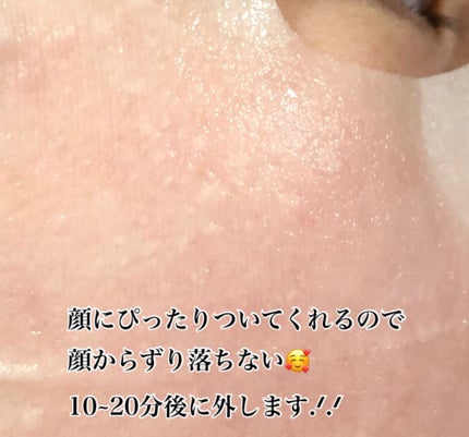 弱酸性pHシートマスク ドクダミフィット/Abib /シートマスク・パックを使ったクチコミ(4枚目)