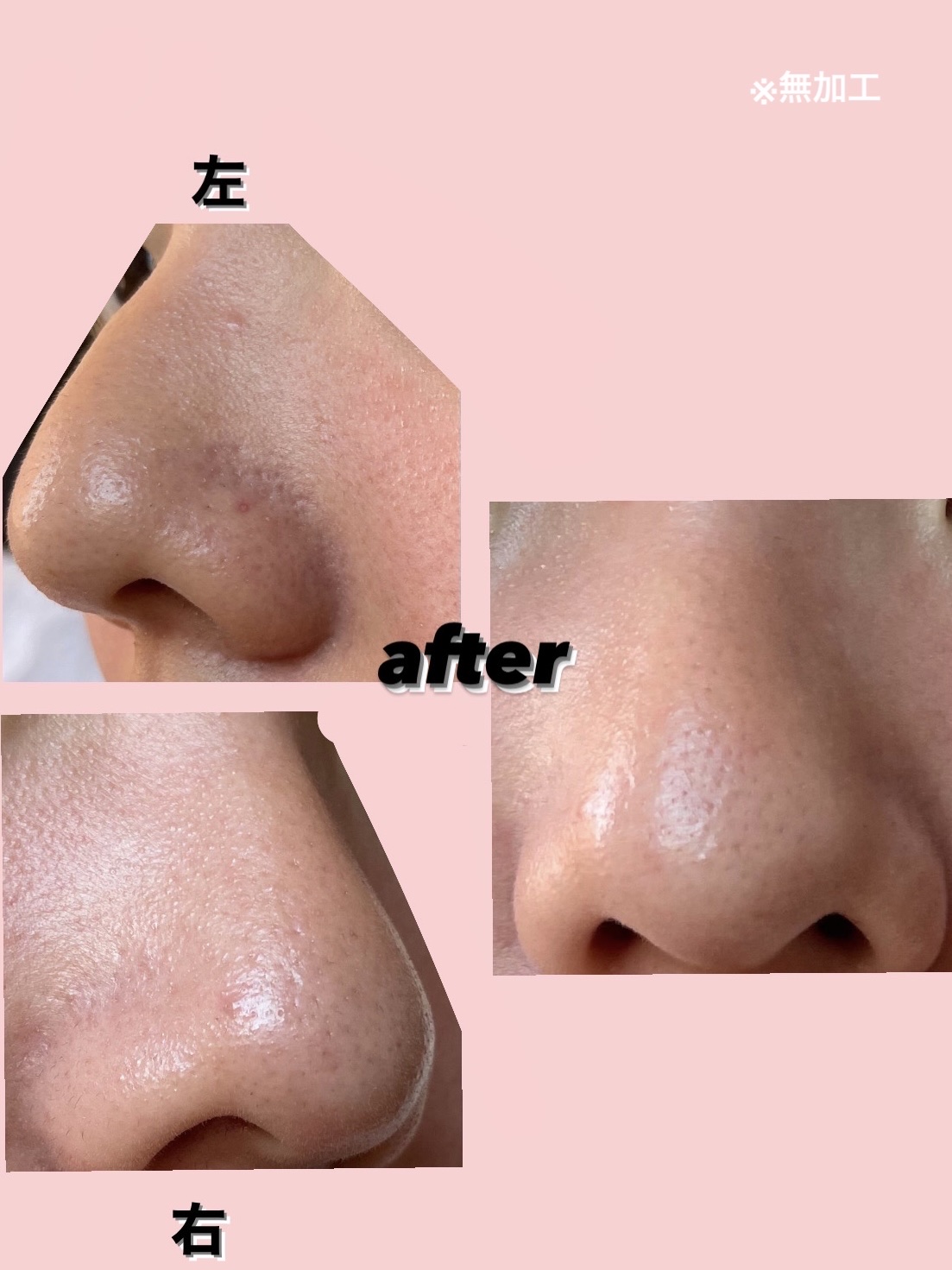 濃密もっちり泡立てネット/ファンケル/その他スキンケアグッズを使ったクチコミ（3枚目）