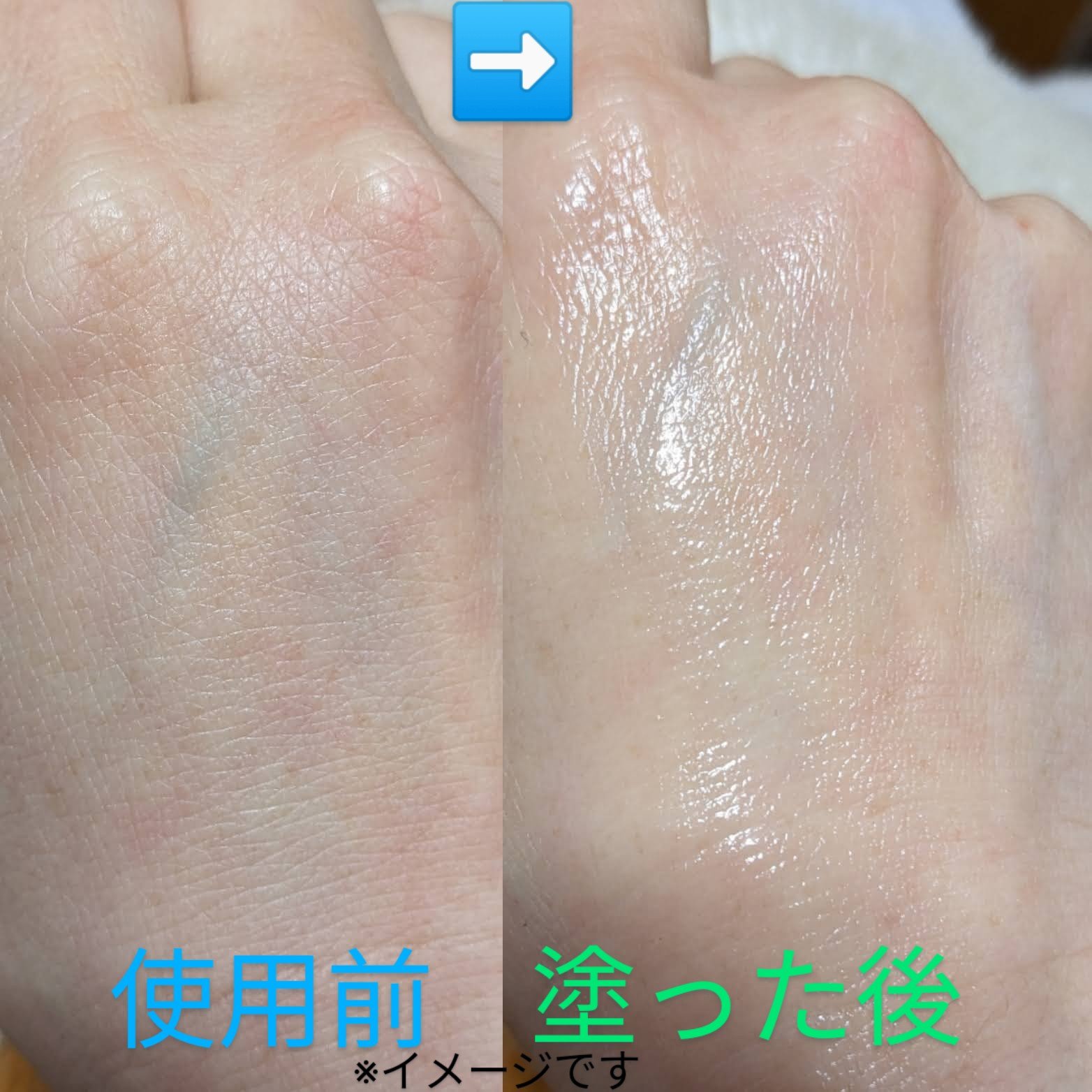 フォーセンス　炭酸生クリームセラム/4SENSE/美容液を使ったクチコミ（3枚目）