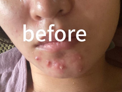 CICA ダブルミスト/VT/ミスト状化粧水を使ったクチコミ(1枚目)