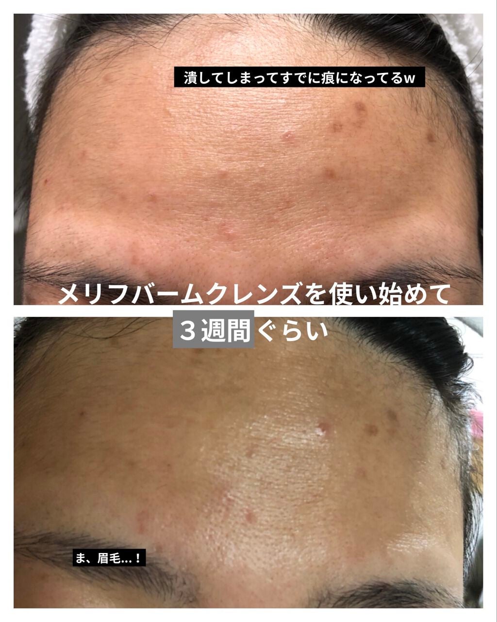 クリアトライアルセット M(しっとりタイプ)/オルビス/トライアルキットを使ったクチコミ(2枚目)