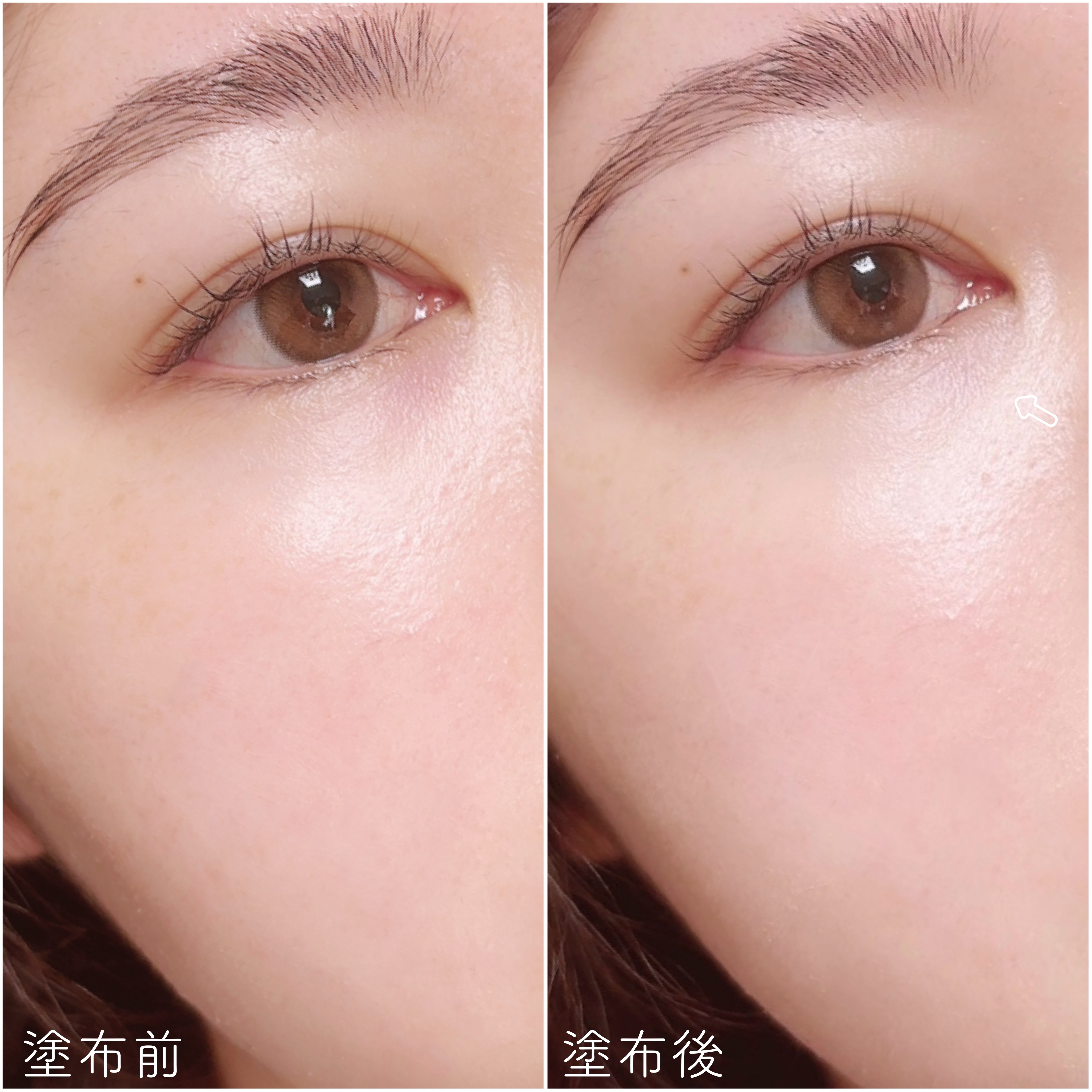 ダーマシンコンシーラー/23years old/リキッドコンシーラーを使ったクチコミ（3枚目）