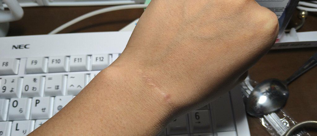 ヴィーナス エンブレイス5/Gillette Venus/ボディグッズを使ったクチコミ（1枚目）