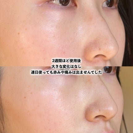 TX-Cream/Dr.Melaxin/フェイスクリームを使ったクチコミ(6枚目)