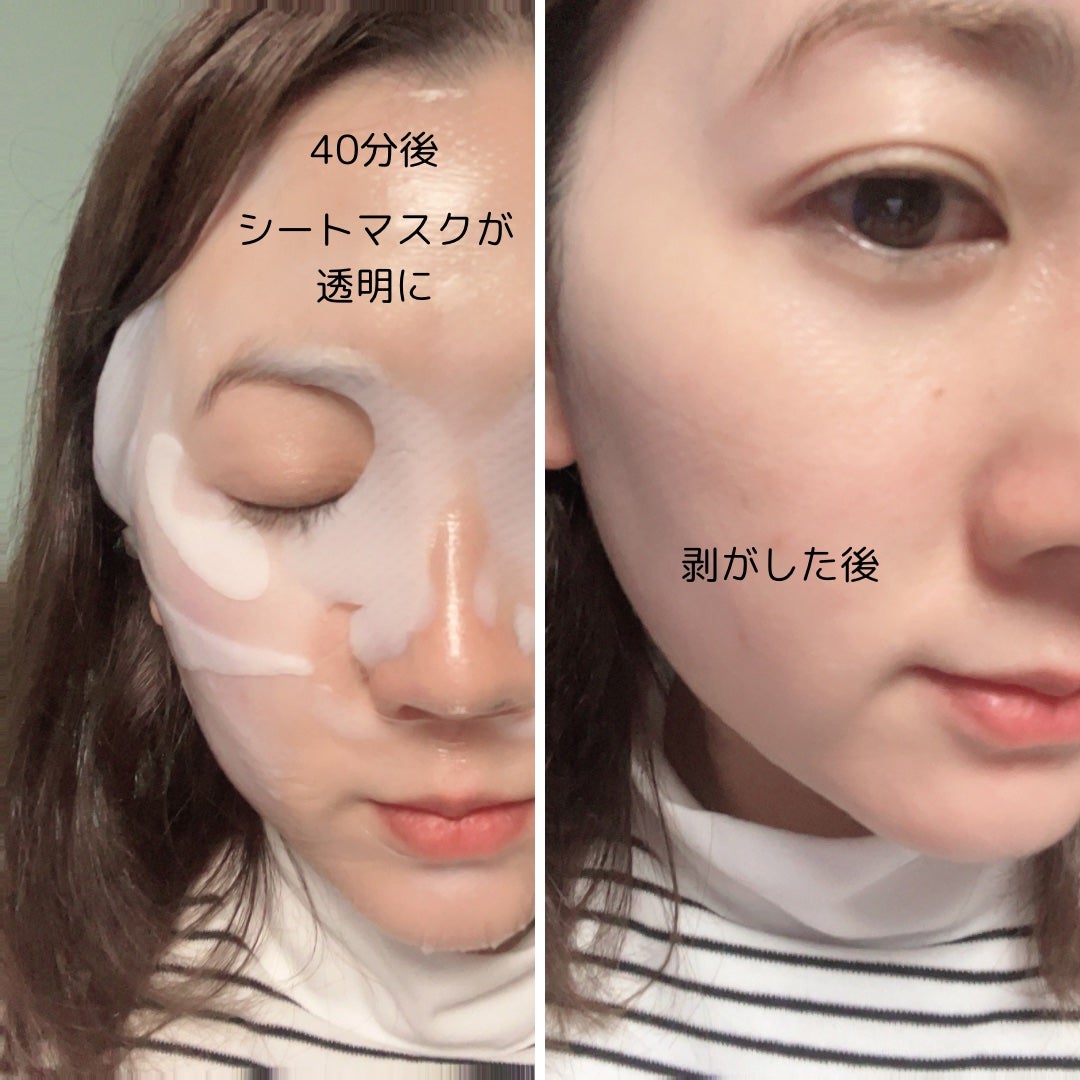 パーフェクト リアル パフォーマンス コラーゲンマスクパック /ダーマフィックス/シートマスク・パックを使ったクチコミ(7枚目)
