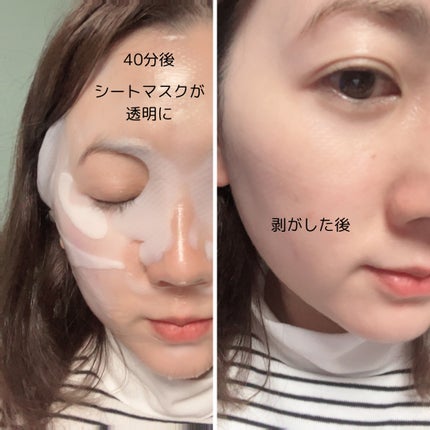 パーフェクト リアル パフォーマンス コラーゲンマスクパック /ダーマフィックス/シートマスク・パックを使ったクチコミ(7枚目)