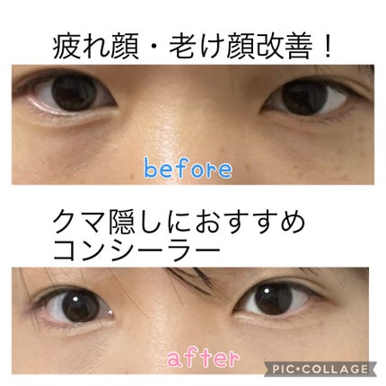 Dior ディオールスキン フォーエヴァー スキン コレクト コンシーラーのクチコミ「❤︎Dior ディオールスキン フォーエヴァー スキン コレクト コンシーラー
1CRク.....」(1枚目)