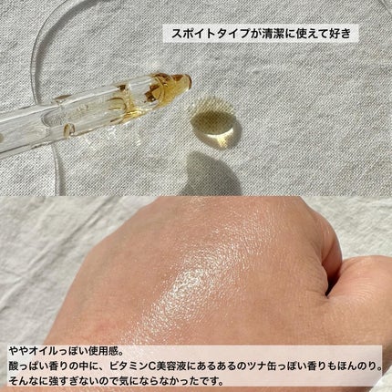 ãããðæçš¿ããæ¹ãã©ãã on LIPS ããPRãæ°žé ã«æ§ãããéæçŸè/V3ãã¡ã³ããŒã·ã§ã³ã§æåãªS..ãïŒ5æç®ïŒ