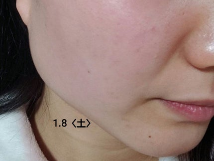 グリーン ダーマCICAビックトナー/ネイチャーリパブリック/化粧水を使ったクチコミ(9枚目)