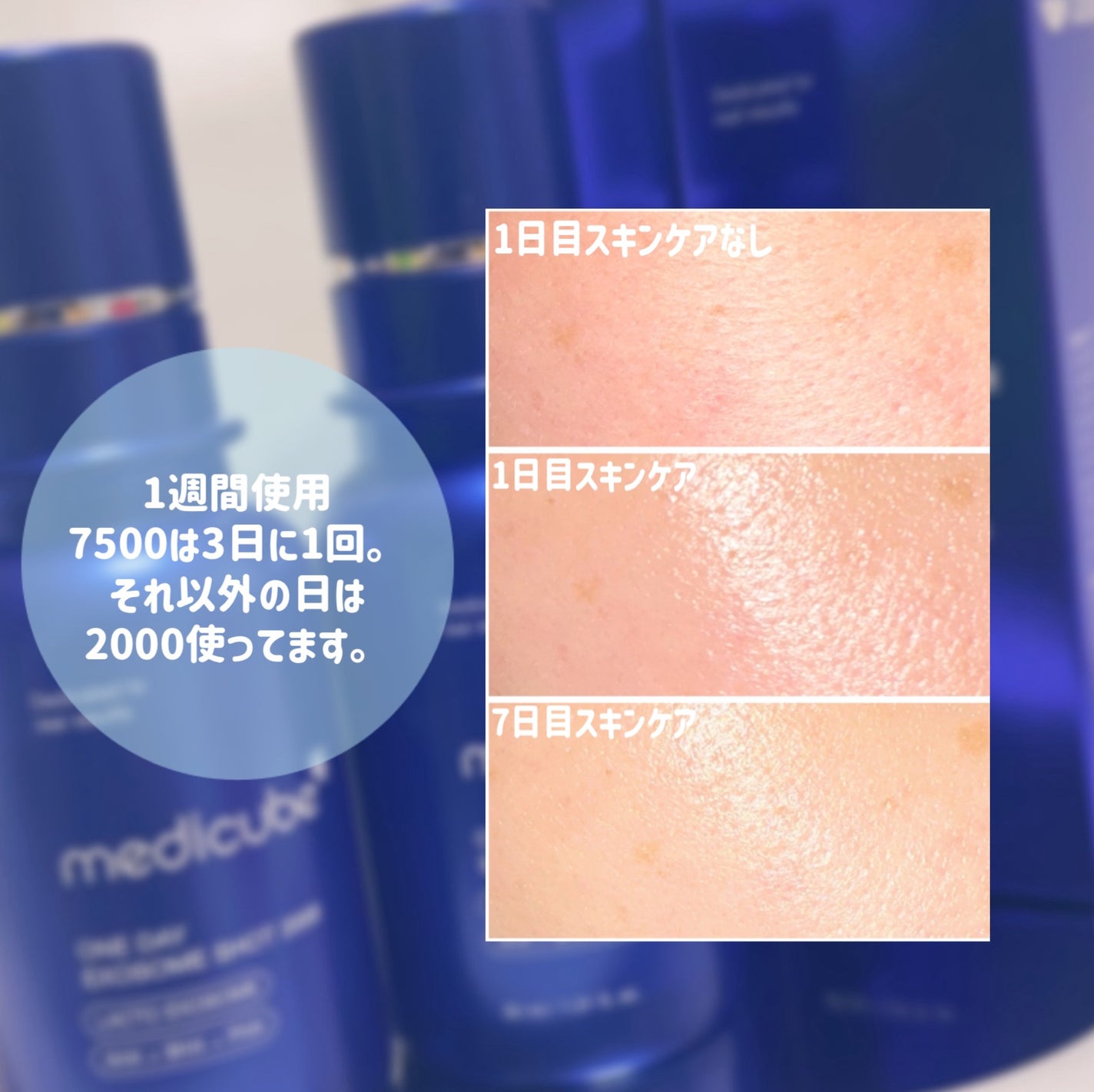 ゼロ1DAYエクソソームショット2000/MEDICUBE/美容液を使ったクチコミ(3枚目)