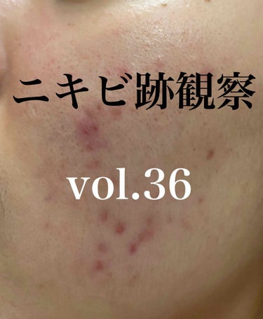 敏感肌用薬用美白美容液/無印良品/美容液を使ったクチコミ（1枚目）