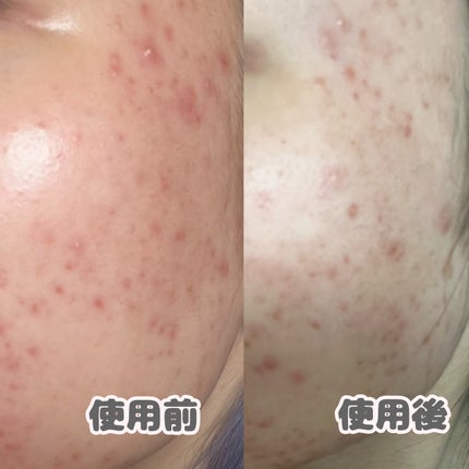 クリアフル トライアルセット L/オルビス/トライアルキットを使ったクチコミ(2枚目)