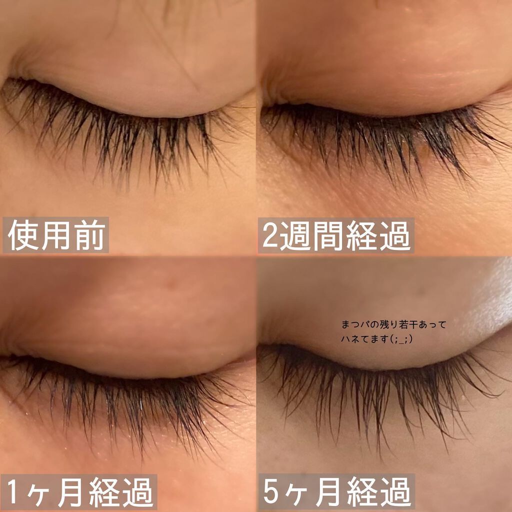 エグータム|アルマダスタイルの効果に関する口コミ - ✓アルマダ