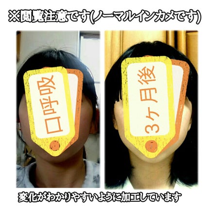 安眠マウステープ/DAISO/その他を使ったクチコミ(4枚目)