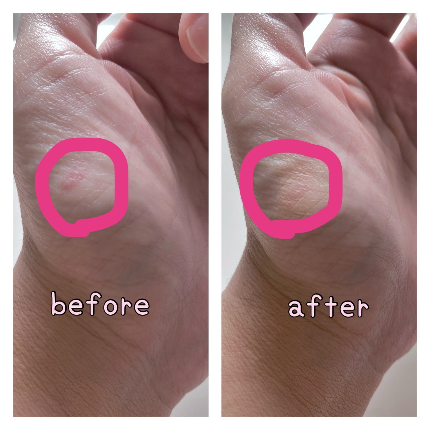 デザイニング コンシーラー/ブリリアージュ/リキッドコンシーラーを使ったクチコミ(3枚目)