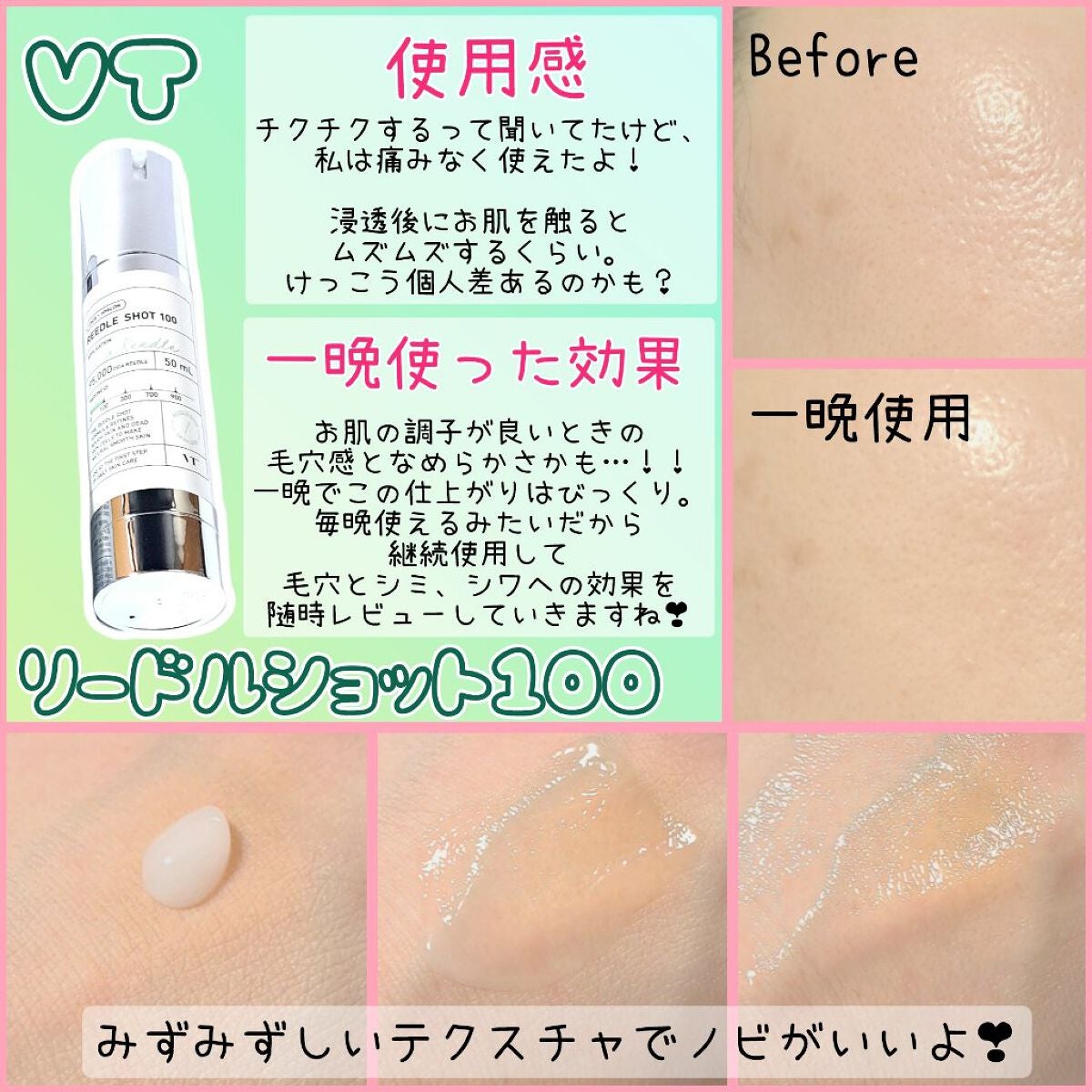 リードルショット100/VT/美容液を使ったクチコミ(2枚目)