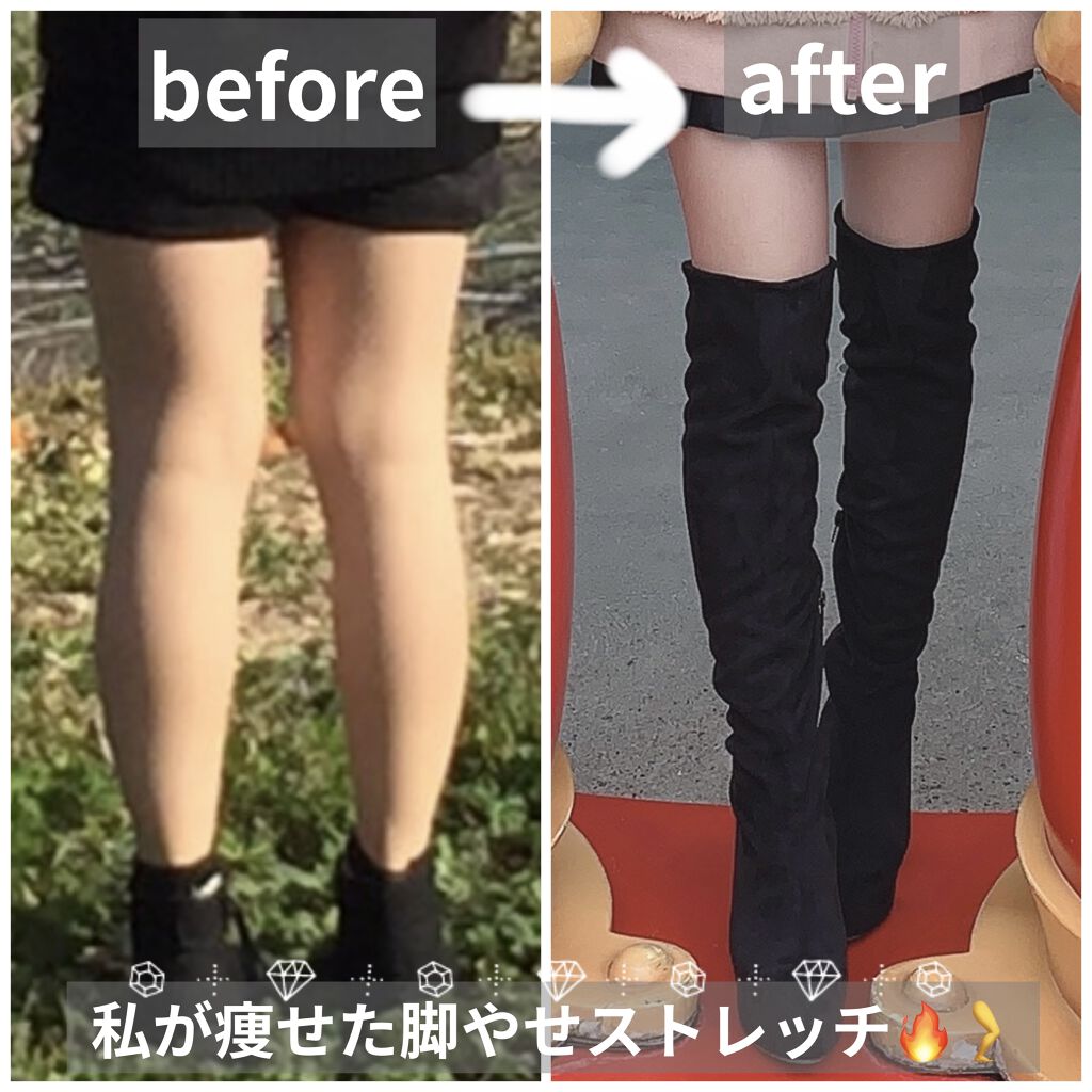 寝ながらメディキュット フルレッグ/メディキュット/着圧ソックス・レギンスを使ったクチコミ（1枚目）