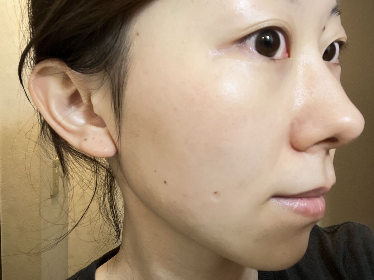 うるおいローション/シンプルバランス/オールインワン化粧品を使ったクチコミ（3枚目）