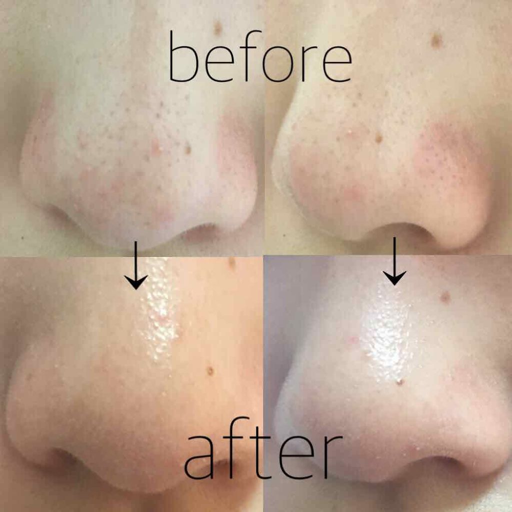 スキンミルク/ettusais/フェイスクリームを使ったクチコミ(3枚目)