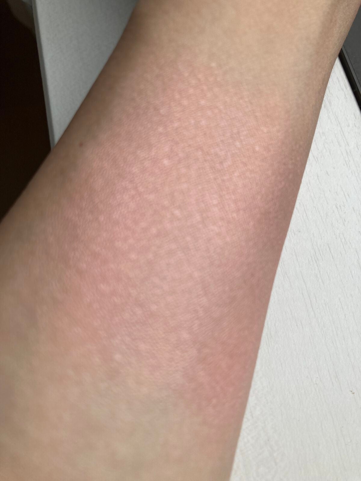 スマイルアップチークスS/コフレドール/パウダーチークを使ったクチコミ(2枚目)