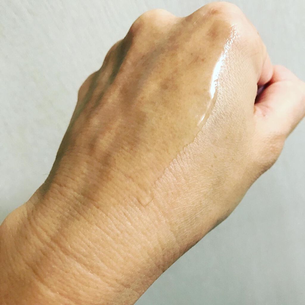 バイオイル/バイオイル/フェイスオイルを使ったクチコミ(5枚目)