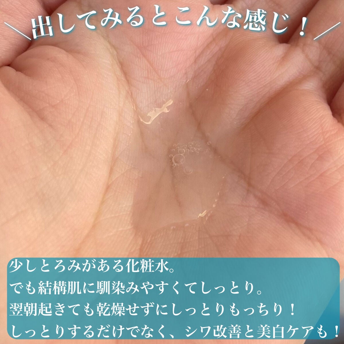 薬用マイクロバブルローション/Macchia Label/化粧水を使ったクチコミ(7枚目)