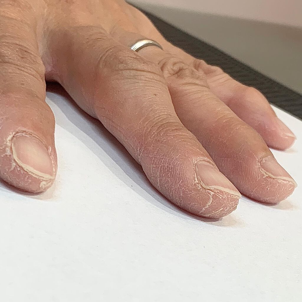 ベビーワセリン/健栄製薬/ボディクリームを使ったクチコミ(8枚目)