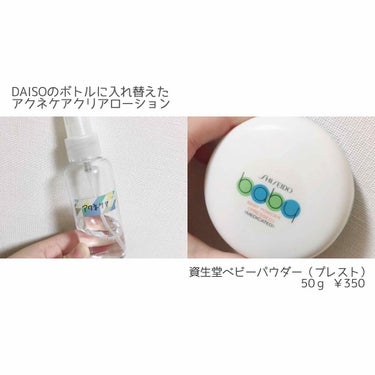 薬用 アクネケア クリアローション/DAISO/化粧水を使ったクチコミ（3枚目）