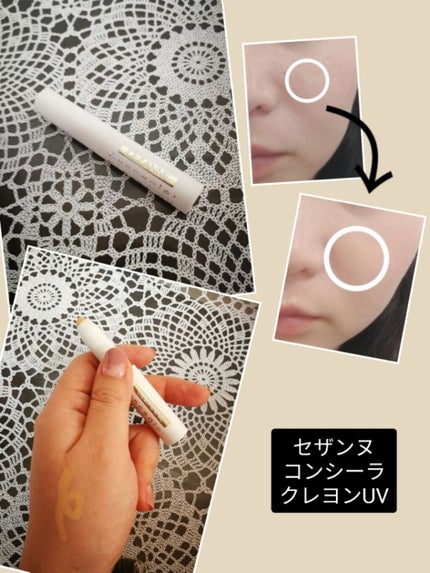 スティックコンシーラーA/KATE/スティックコンシーラーを使ったクチコミ(1枚目)