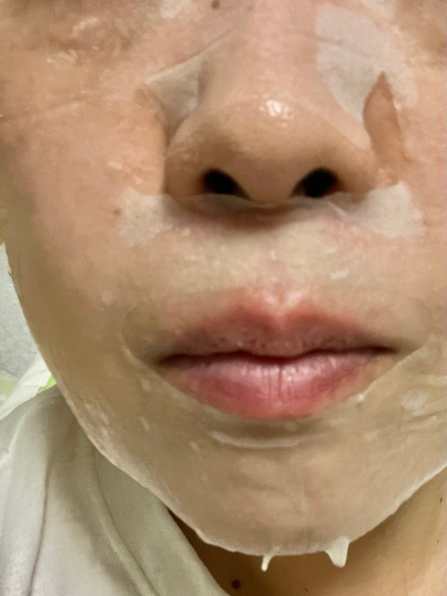 シカアルブチンマスク/NOWATER/シートマスク・パックを使ったクチコミ(6枚目)