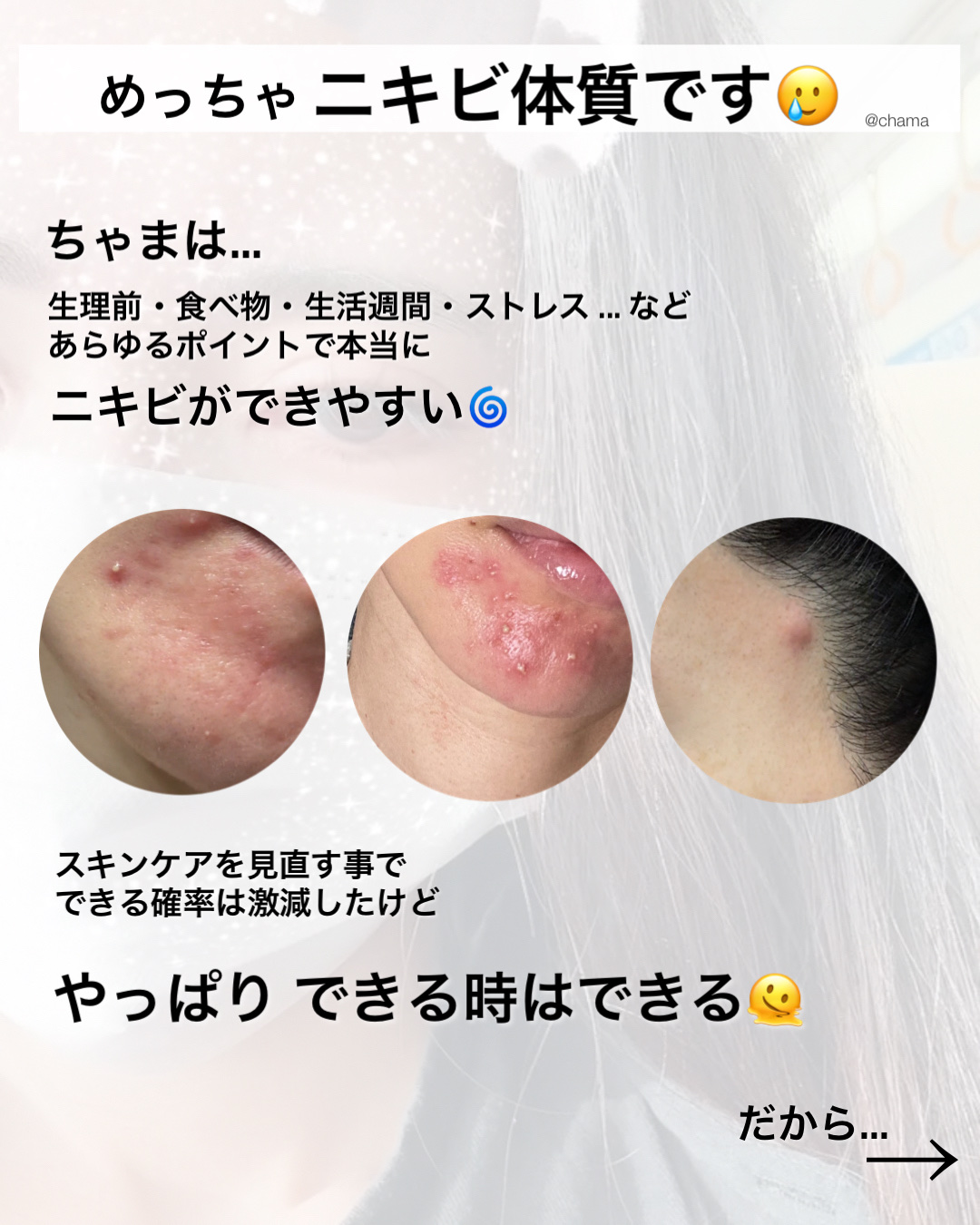 シカテロル スポットトリートメント/beplain/フェイスクリームを使ったクチコミ（2枚目）