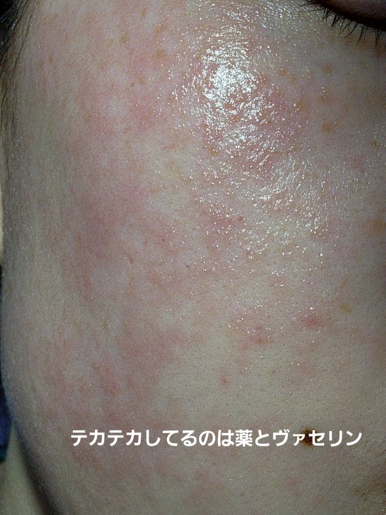 グルタ ビタミンC トーニング アンプル/IOPE/美容液を使ったクチコミ（3枚目）