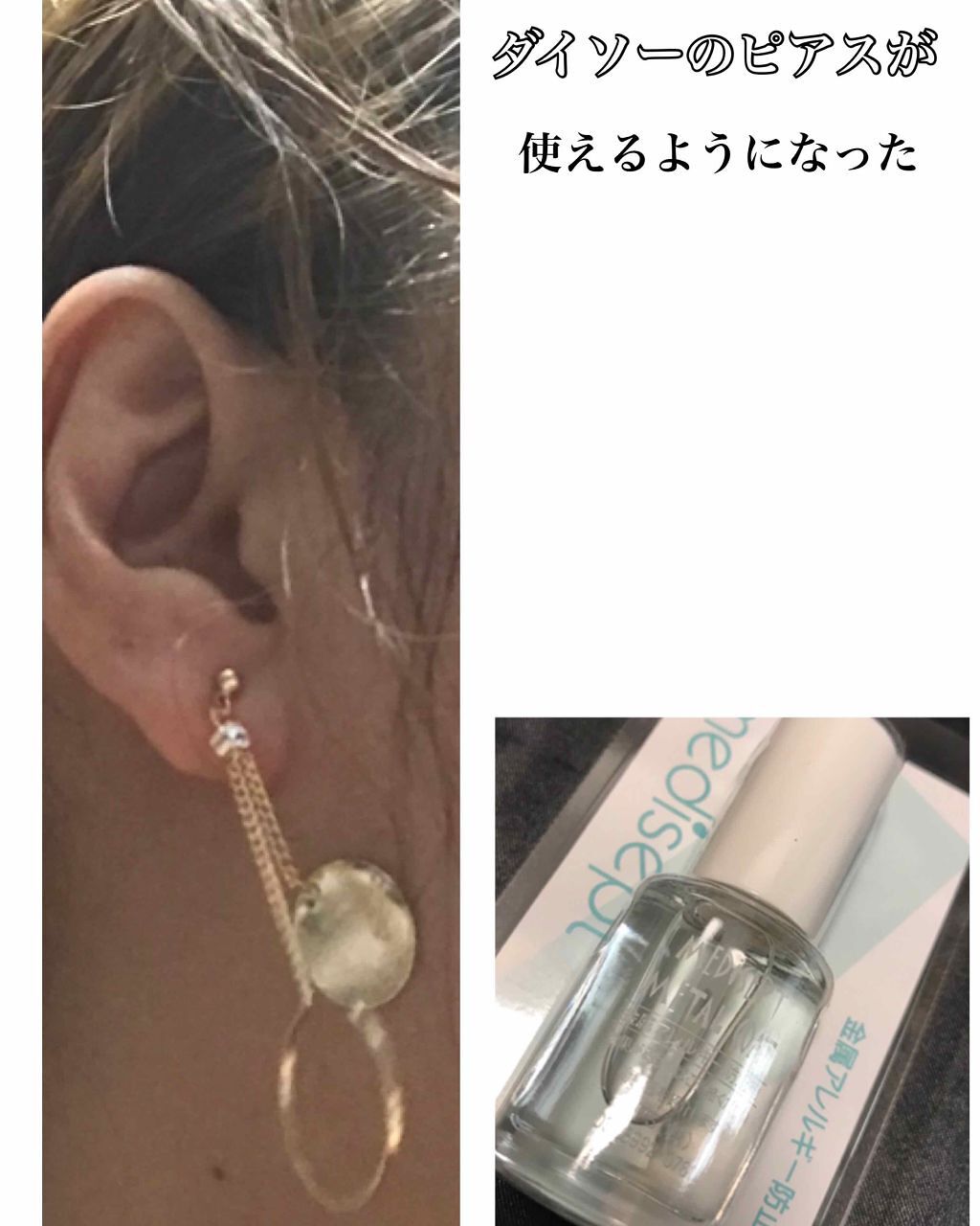 MediSept Metal Coat/medisept/その他を使ったクチコミ（1枚目）