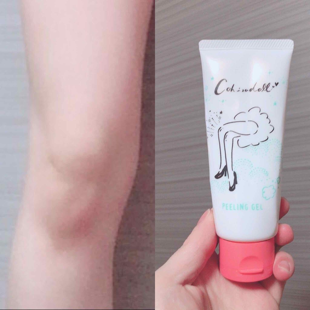ひざピーリングジェル/コヒザドール/レッグ・フットケアを使ったクチコミ(1枚目)