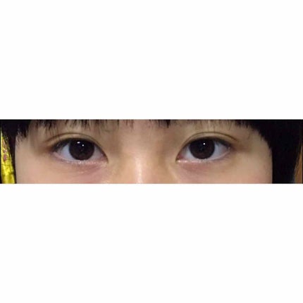 【旧品】オリシキ アイリッドスキンフィルム/D-UP/二重まぶた用アイテムを使ったクチコミ(2枚目)