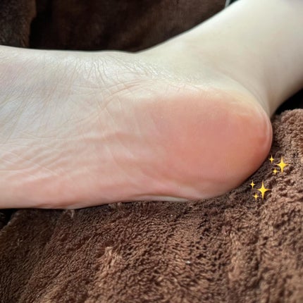 かかと どうスルん??そうスルんDX/Stay Free/レッグ・フットケアを使ったクチコミ(7枚目)