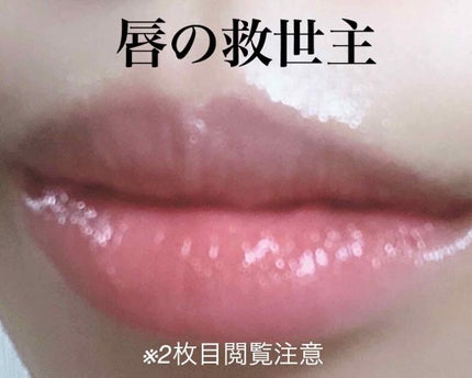 モアリップ N (医薬品)/資生堂薬品/その他を使ったクチコミ(1枚目)