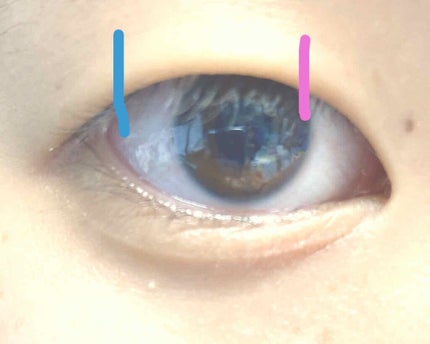 のびるアイテープ/セリア/二重まぶた用アイテムを使ったクチコミ(4枚目)