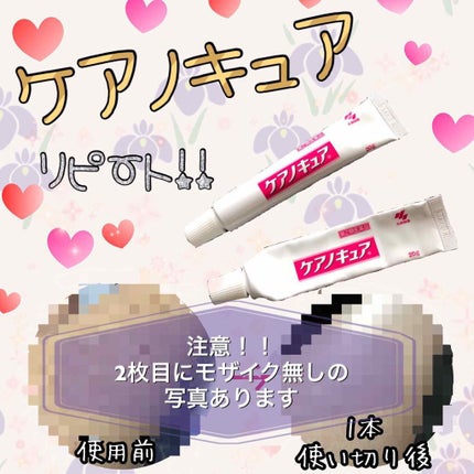 ケアノキュア(医薬品)/小林製薬/その他を使ったクチコミ(1枚目)