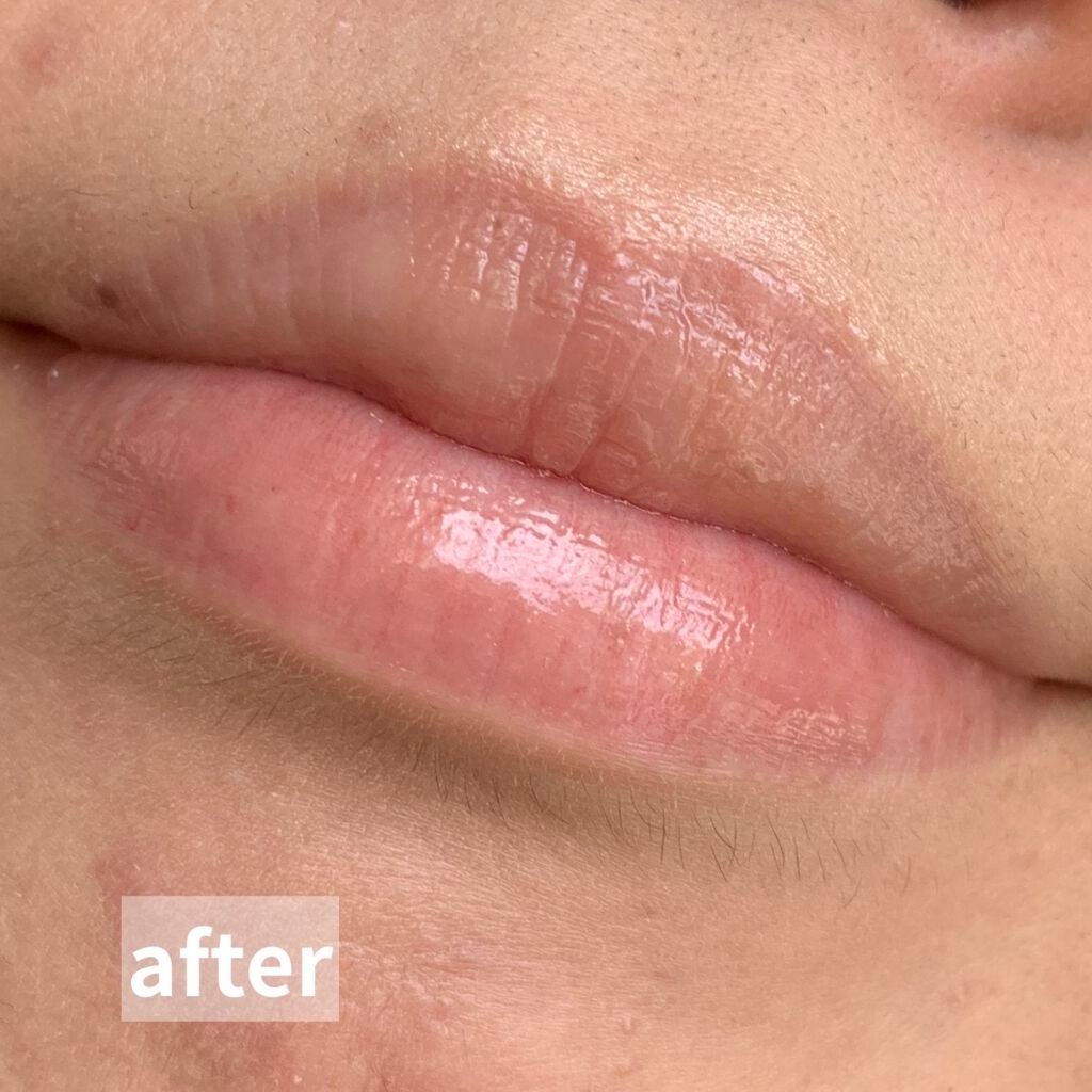 Balm Dotcom/Glossier./リップバームを使ったクチコミ(7枚目)