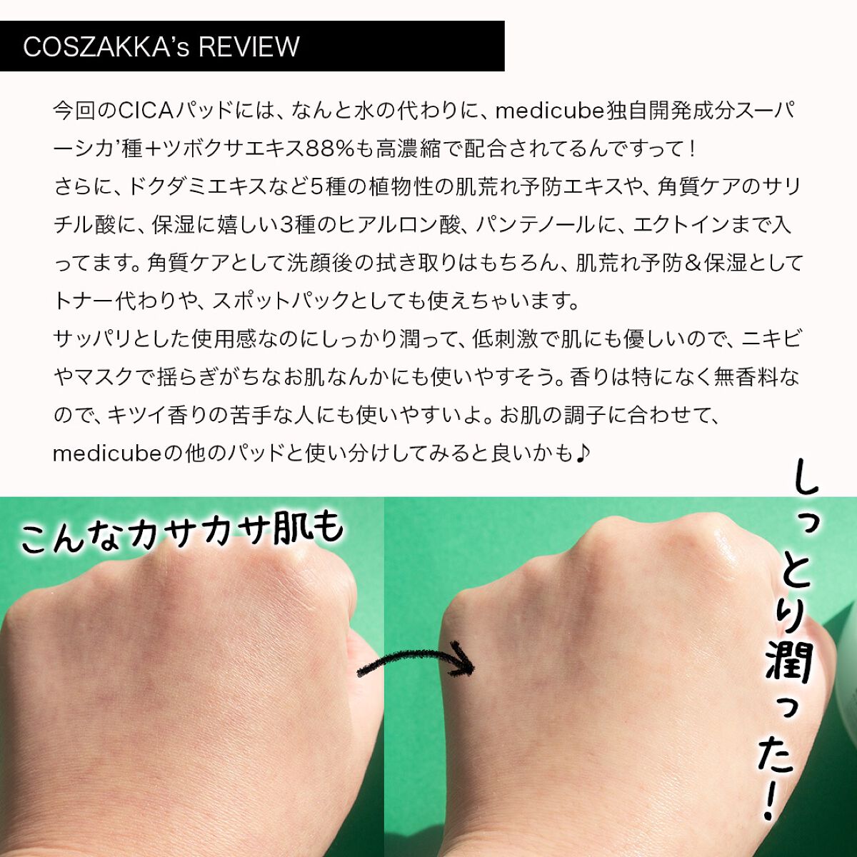 スーパーシカパッド/MEDICUBE/トナーパッドを使ったクチコミ（3枚目）