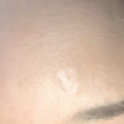 極薄透明パッチ nikipa!/金冠堂/にきびパッチを使ったクチコミ(4枚目)