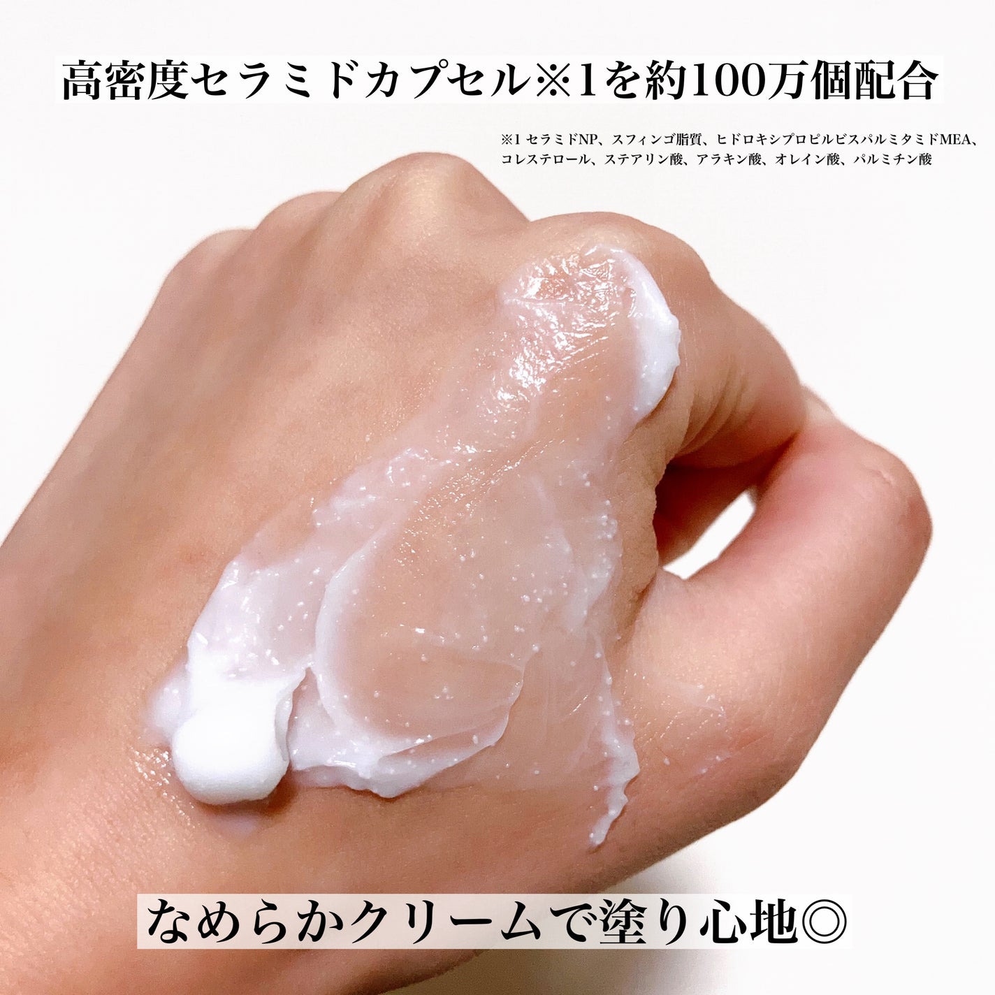 アトバリア365クリーム/AESTURA/フェイスクリームを使ったクチコミ(4枚目)